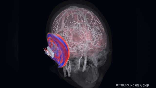 Aleph Neuro y Butterfly Network presentan imágenes 3D del cerebro de resolución récord con ultrasonido en un chip