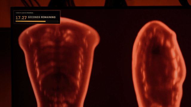 Midjourney Medical: la expansión de Midjourney hacia la imagenología médica con su Ultrasonic CT